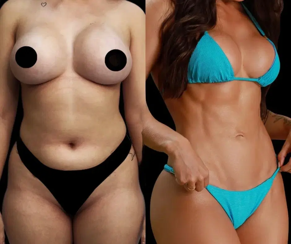 7ª imagem da campanha